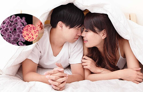 Quan hệ tình dục không an toàn